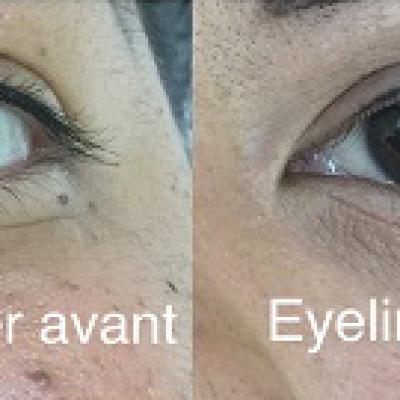 Yeux 3