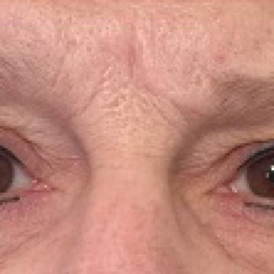 Yeux 4