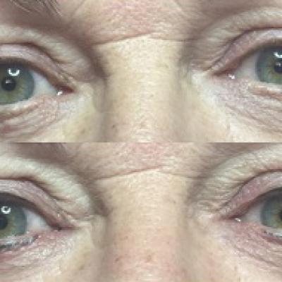 Yeux 5